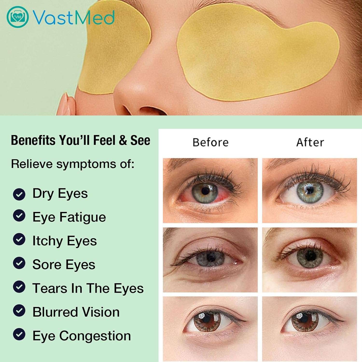VASTMED Pairs Eye Protection Patch A-Type Soft Disposable Eye Pads for Eye Care, Vision Therapy, Recovery & Clinical Use – Gentle Adhesion for Sensitive Skin – for Adults & Kids - Image 5