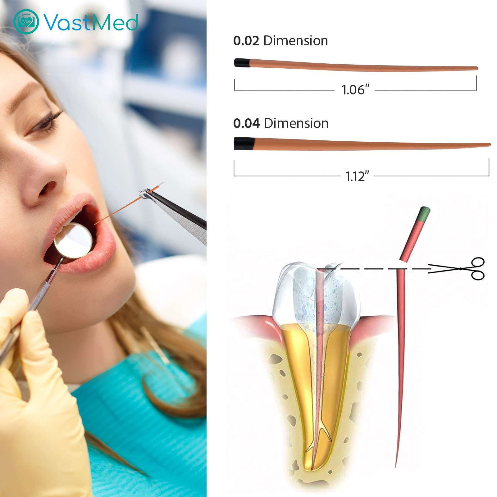 Dental Gutta Percha Points by Vastmed | Dental Endodontic Special Taper - Image 2
